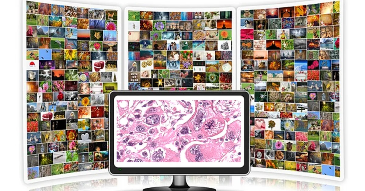 A deep learning framework for efficient pathology image analysis