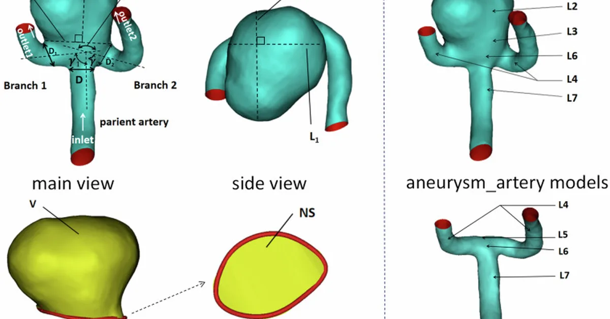 Interpretable Aneurysm Classification via 3D Concept Bottleneck Models: Integrating Morphological and Hemodynamic Clinical Features