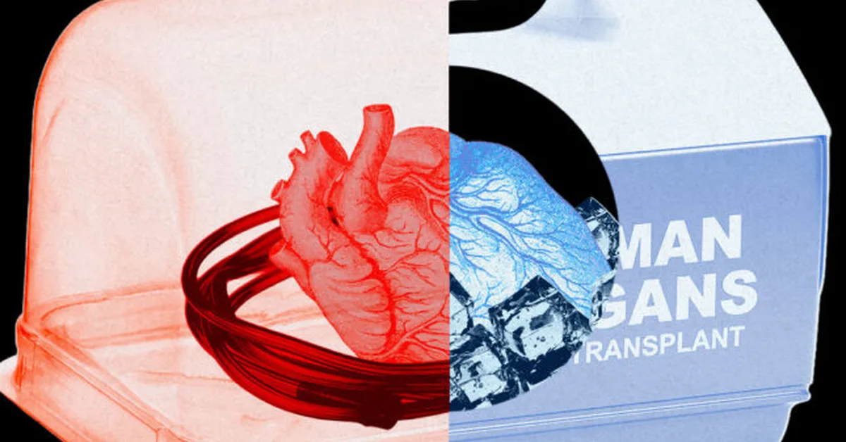 STAT+: New technologies promise to transform organ transplantation. But when?